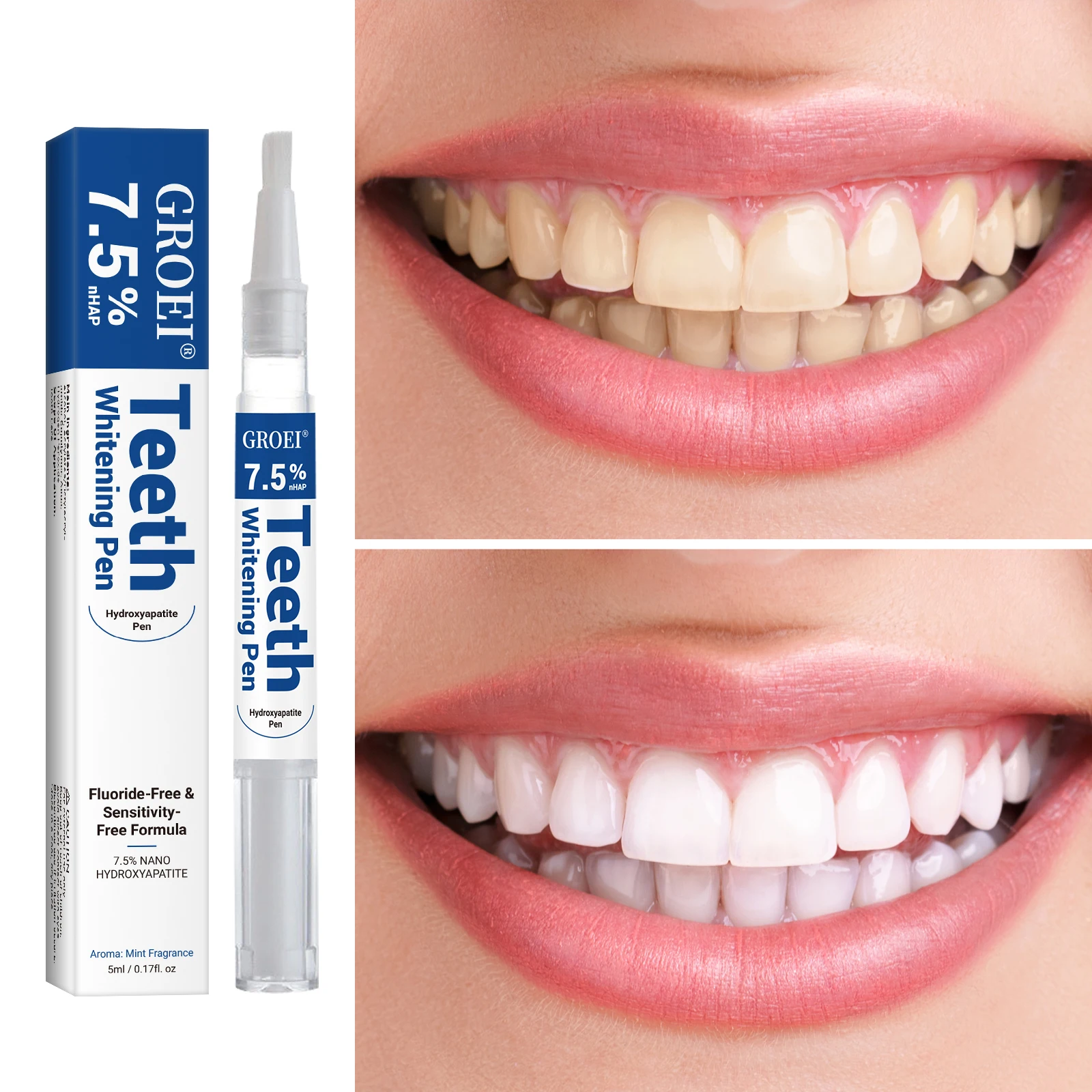 Stylo de blanchiment des dents - Teeth Whitening Singapore avis et prix
