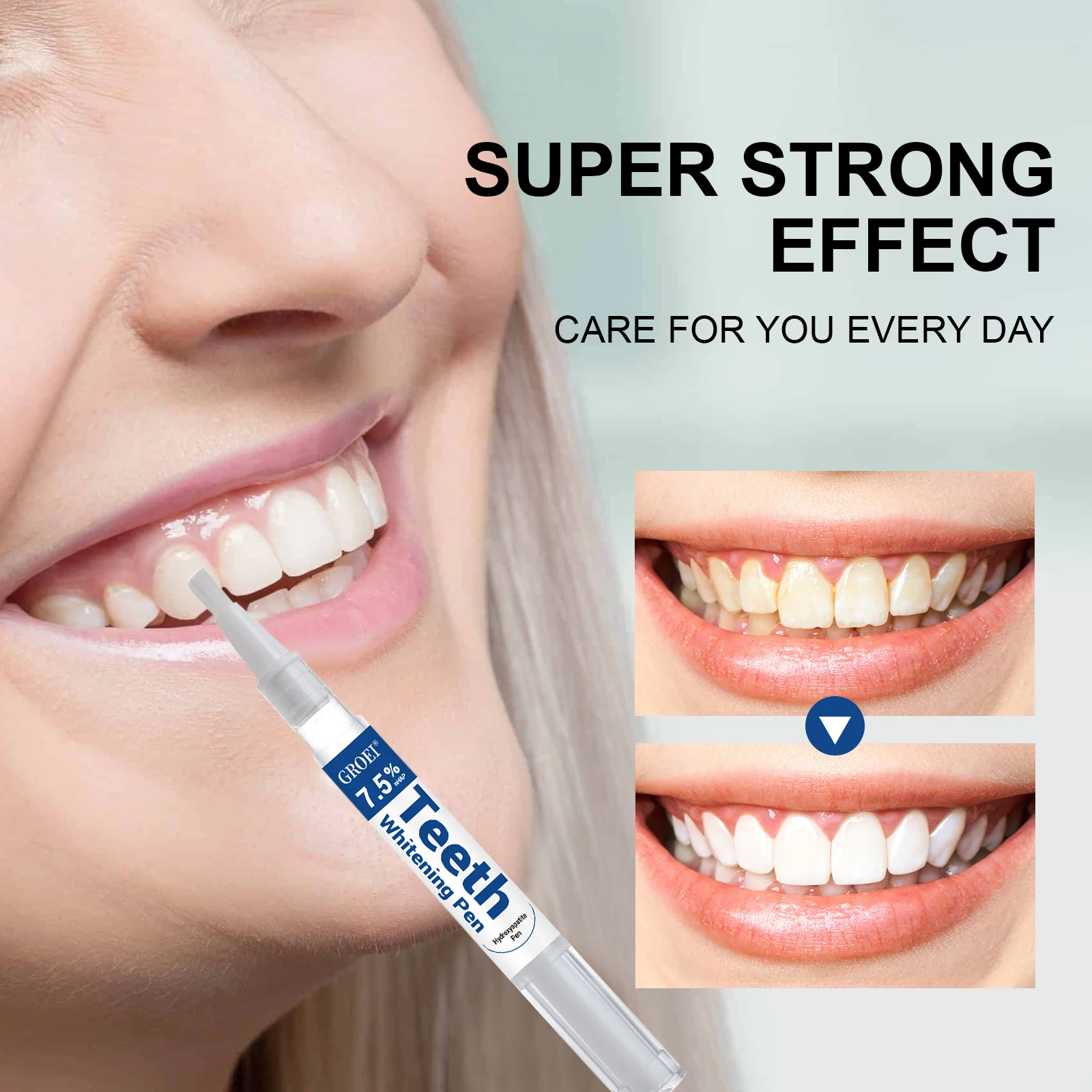 Stylo de blanchiment des dents - Teeth Whitening Singapore avis et prix