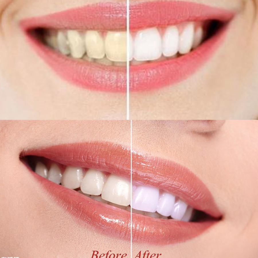 Poudre de charbon de bambou po - Teeth Whitening Singapore avis et prix