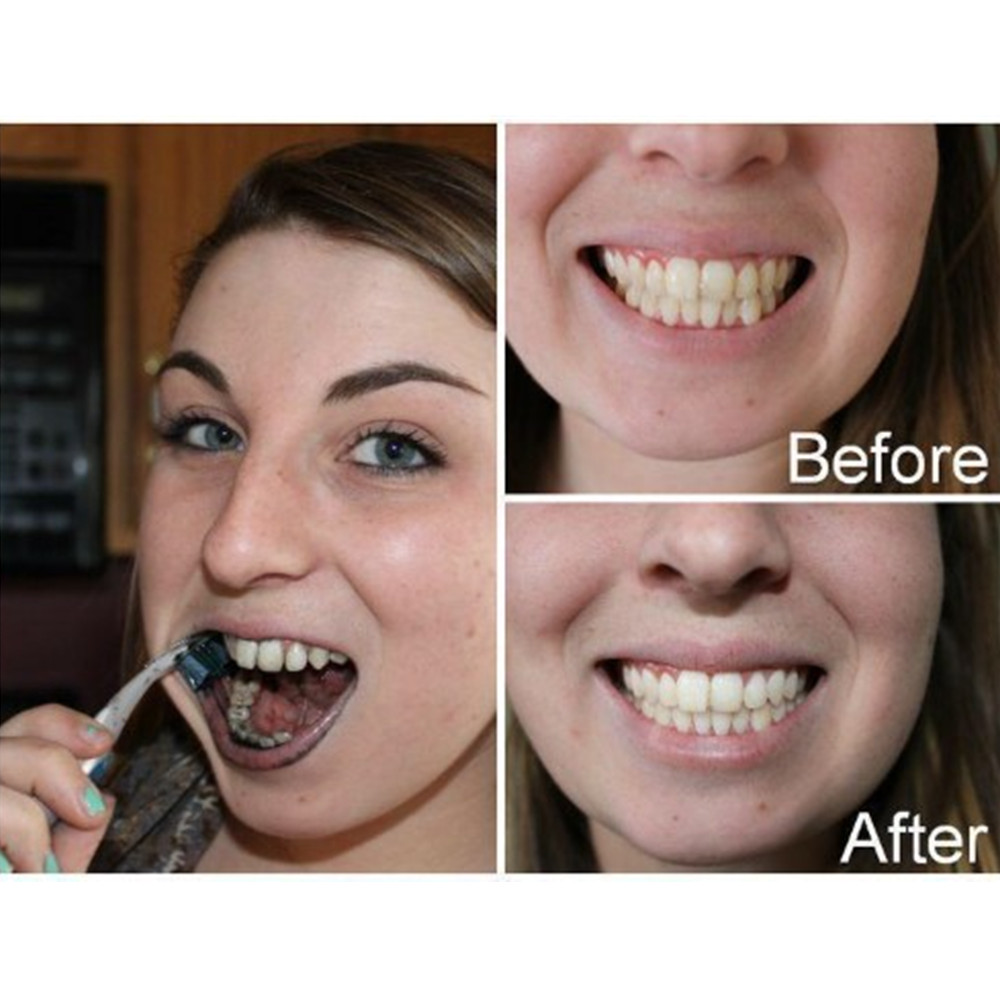 Poudre de charbon de bambou po - Teeth Whitening Singapore avis et prix