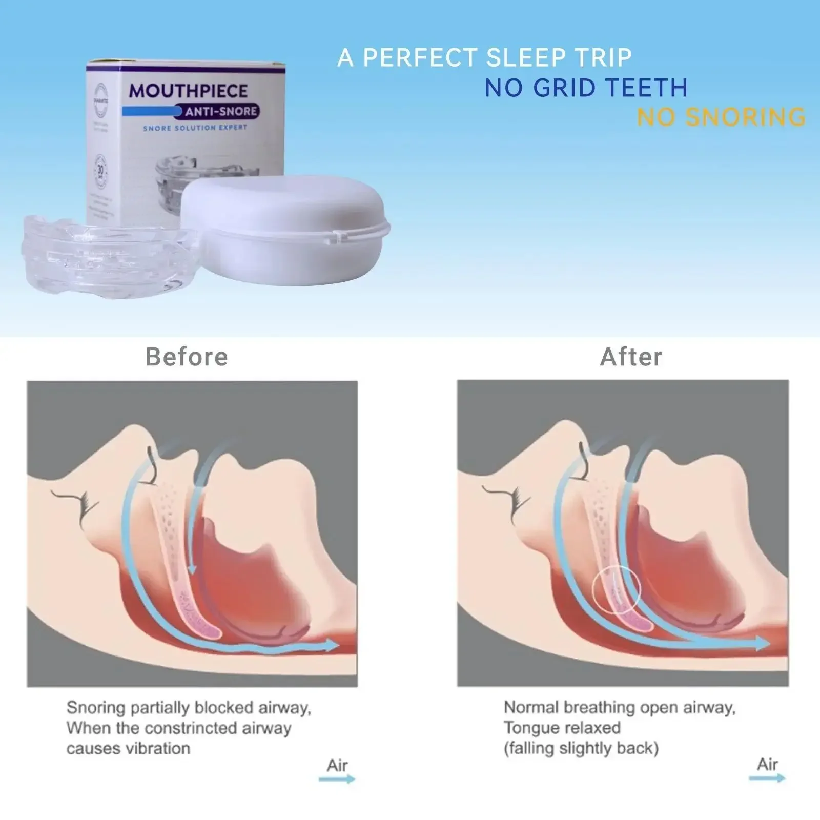 Protège-dents réglable anti-ro - Dental Guard Night avis et prix