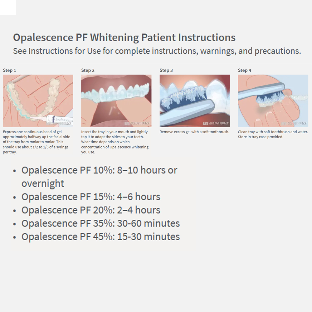 Opalwisdom-Kit de Blanchiment  - Teeth Whitening Singapore avis et prix
