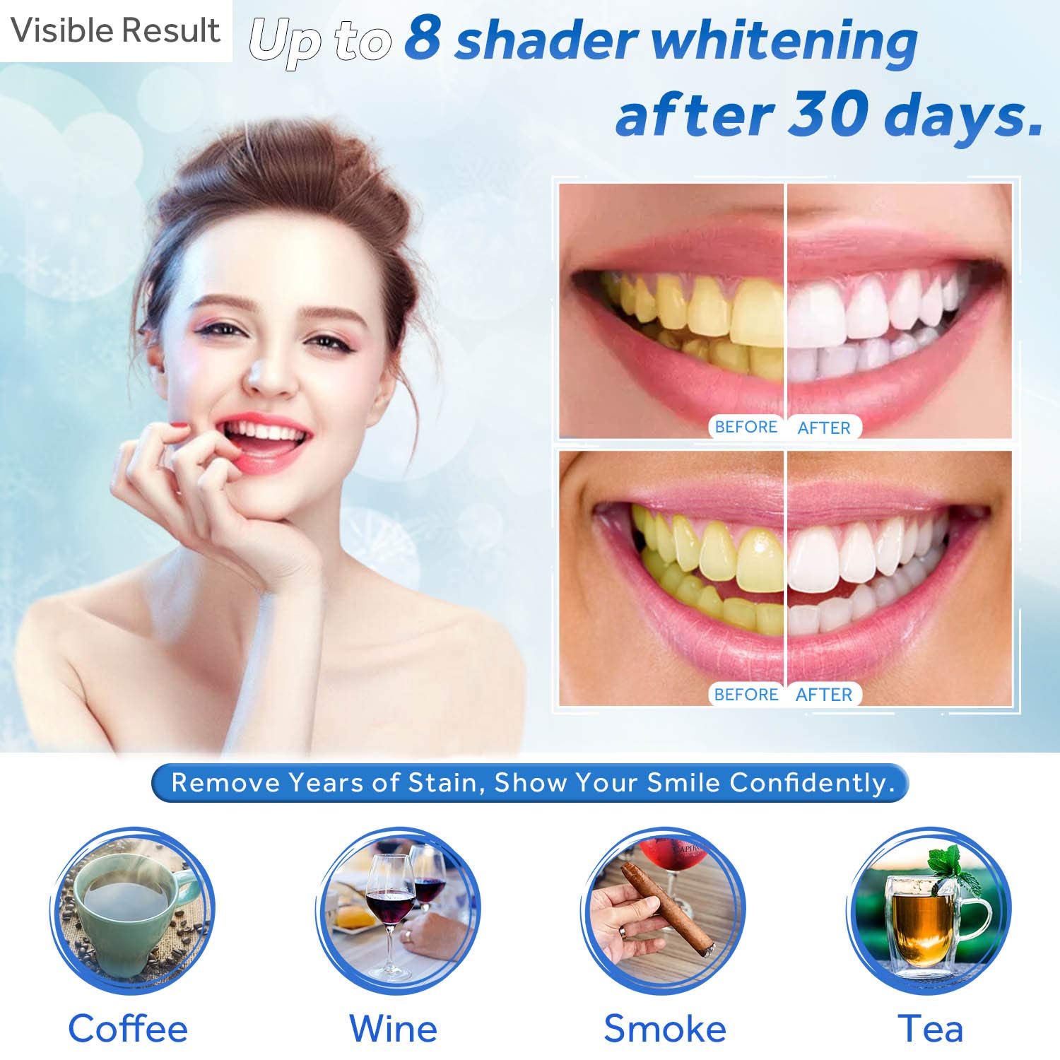Gel de blanchiment des dents r - Teeth Whitening Singapore avis et prix