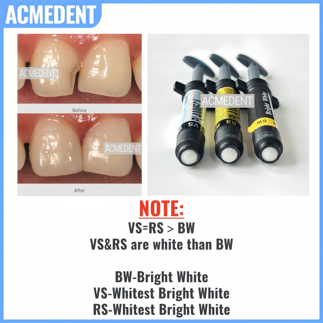 Placage de résine Composite de - Teeth Whitening Vs Veneers avis et prix